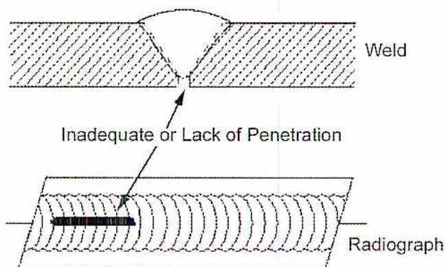 Figure 22: Diagram illustrating Incomplete Penetration. The top part shows a cross-section of a weld joint with a V-groove. The weld metal is represented by diagonal hatching. A label 'Inadequate or Lack of Penetration' with an arrow points to the root area where the weld metal has not fully penetrated the joint. The bottom part shows a radiograph of the same weld joint, where the incomplete penetration appears as a dark, well-defined, straight-edged area along the centerline. Labels 'Weld', 'Inadequate or Lack of Penetration', and 'Radiograph' are present.