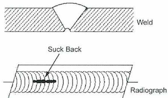 Figure 24: Diagram of Suck Back. The top part shows a cross-section of a weld joint with a V-groove. The bottom part shows a radiograph of the same joint, with a dark, irregular line at the root of the weld, labeled 'Suck Back'.