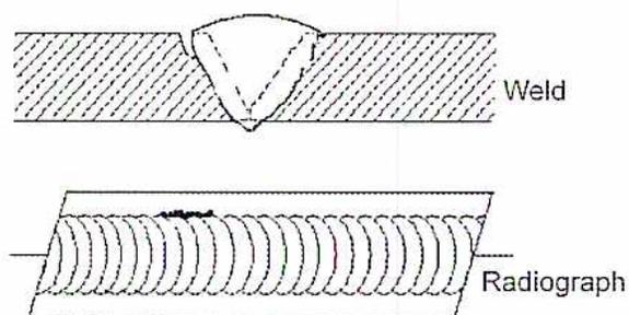 Diagram of external or crown undercut showing a weld cross-section and its radiograph.