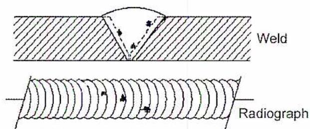Figure 21: Diagram illustrating Slag Inclusions. The top part shows a cross-section of a weld joint with a V-groove. The weld metal is represented by diagonal hatching. Dark, jagged, asymmetrical shapes representing slag inclusions are shown within the weld metal. The bottom part shows a radiograph of the same weld joint, where the slag inclusions appear as dark, irregular shapes against a lighter background. Labels 'Weld' and 'Radiograph' are present.