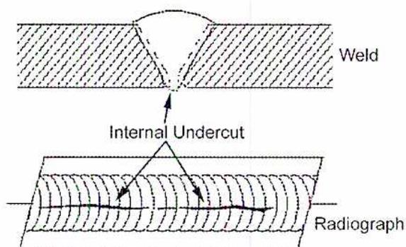 Diagram of internal or root undercut showing a weld cross-section and its radiograph.